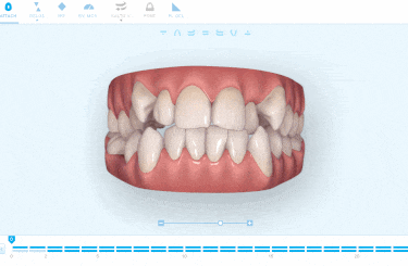 Clinica Dental Especializada en Ortodoncia | Smilestudio