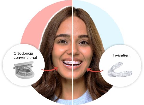 Clinica Dental Especializada en Ortodoncia | Smilestudio